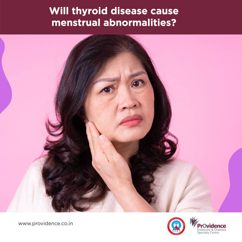 Thyroid disease and menstrual abnormalities