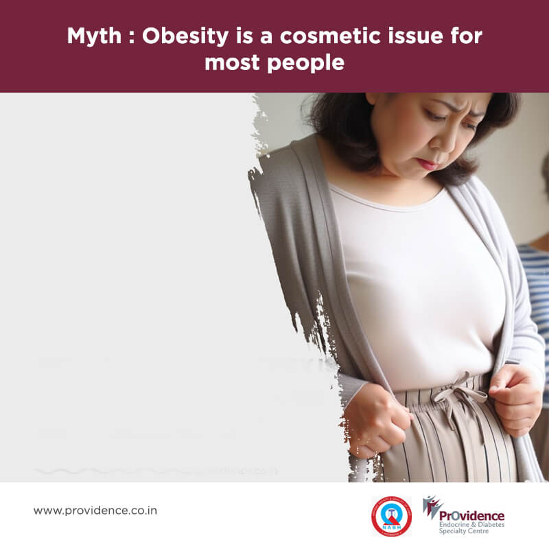 obesity cosmetic issue