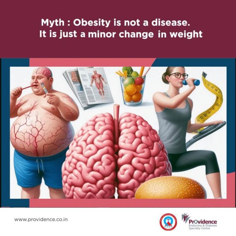 Myth: Obesity is not a disease. It is just a minor change in weight.