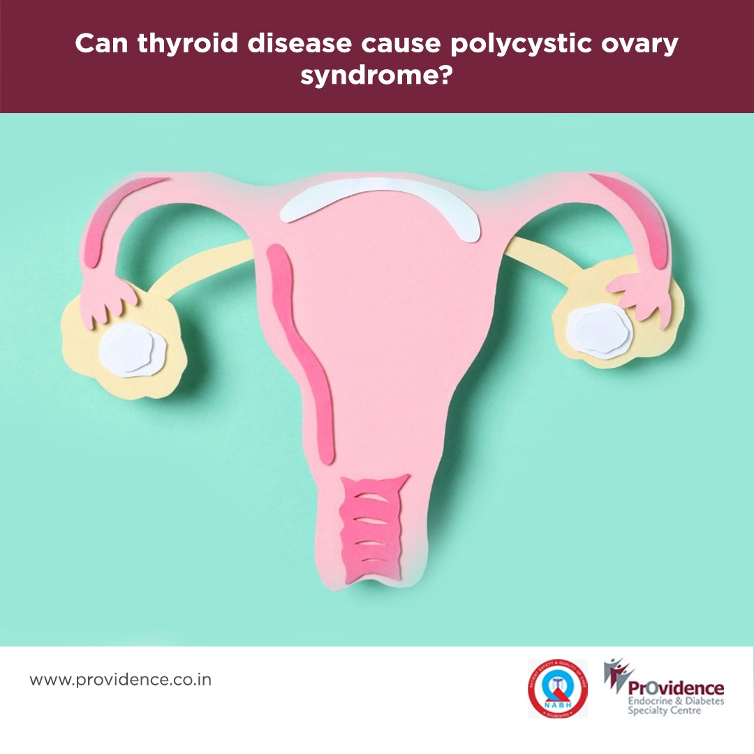 Can thyroid disease cause polycystic ovary syndrome?