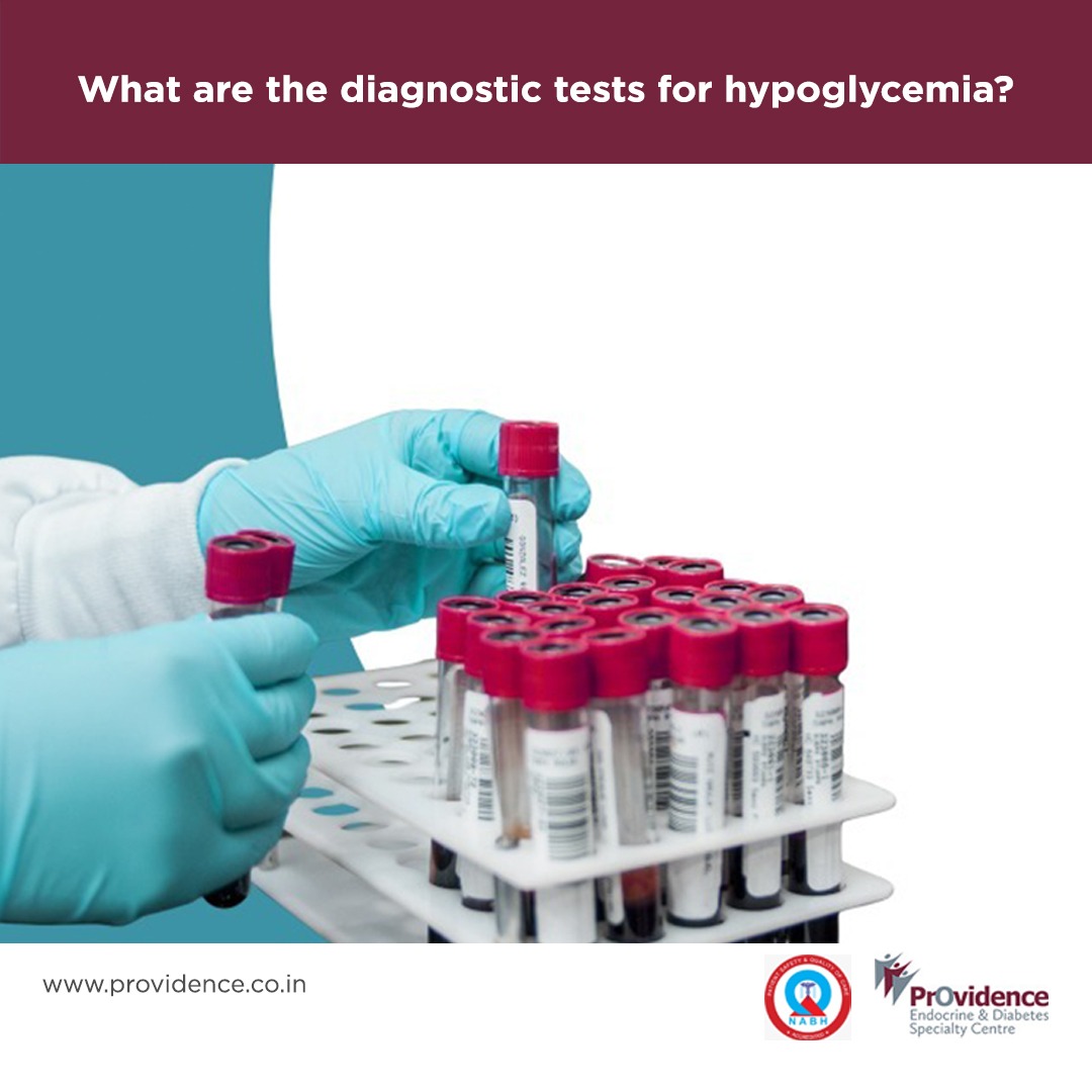 What are the diagnostic tests for hypoglycemia