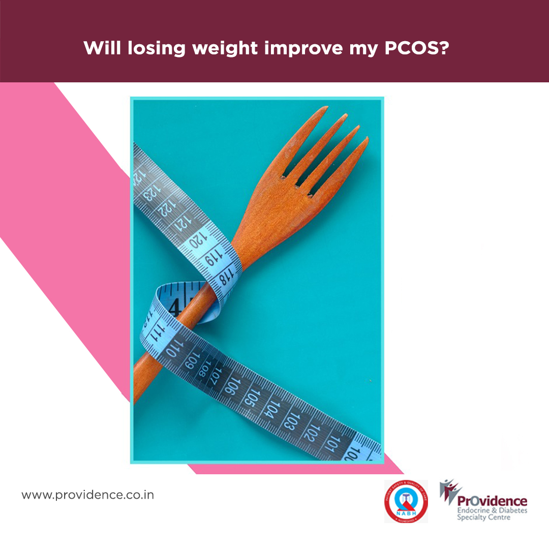 Will losing weight improve my PCOS? 