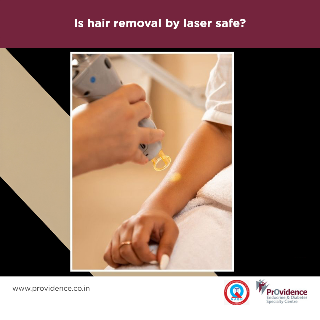 Is hair removal by laser safe?