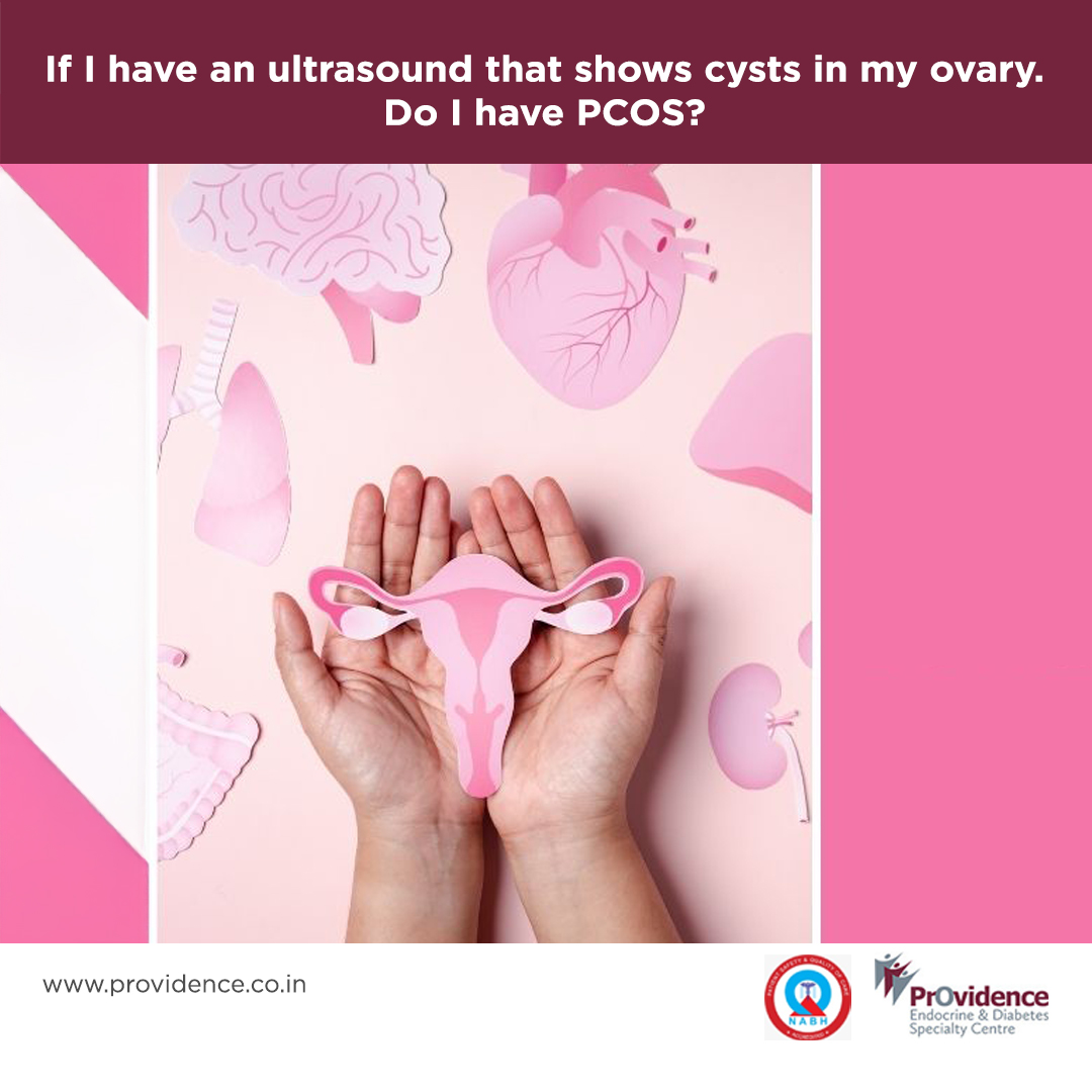 If I have an ultrasound that shows cysts in my ovary, do I have PCOS?