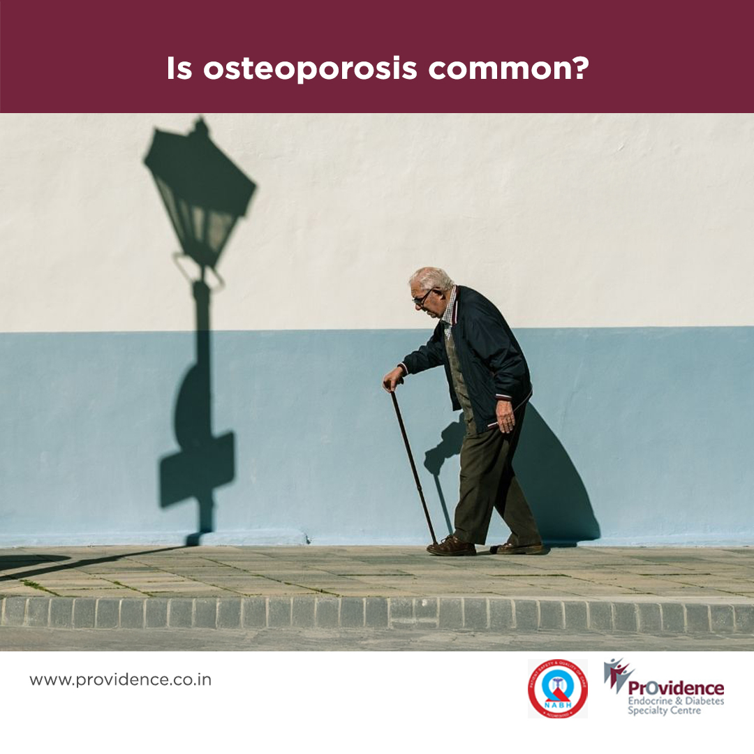 Is osteoporosis common?