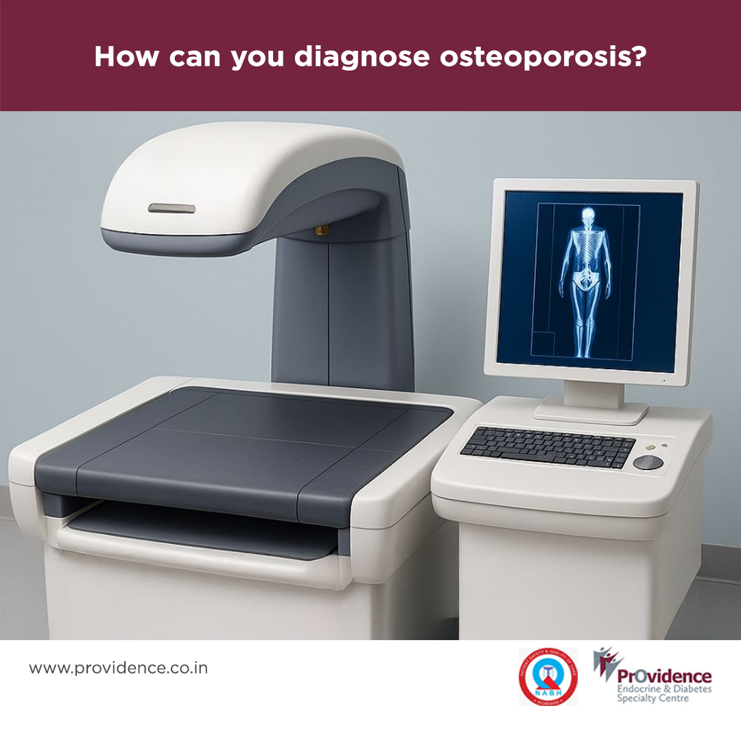 How can you diagnose osteoporosis?